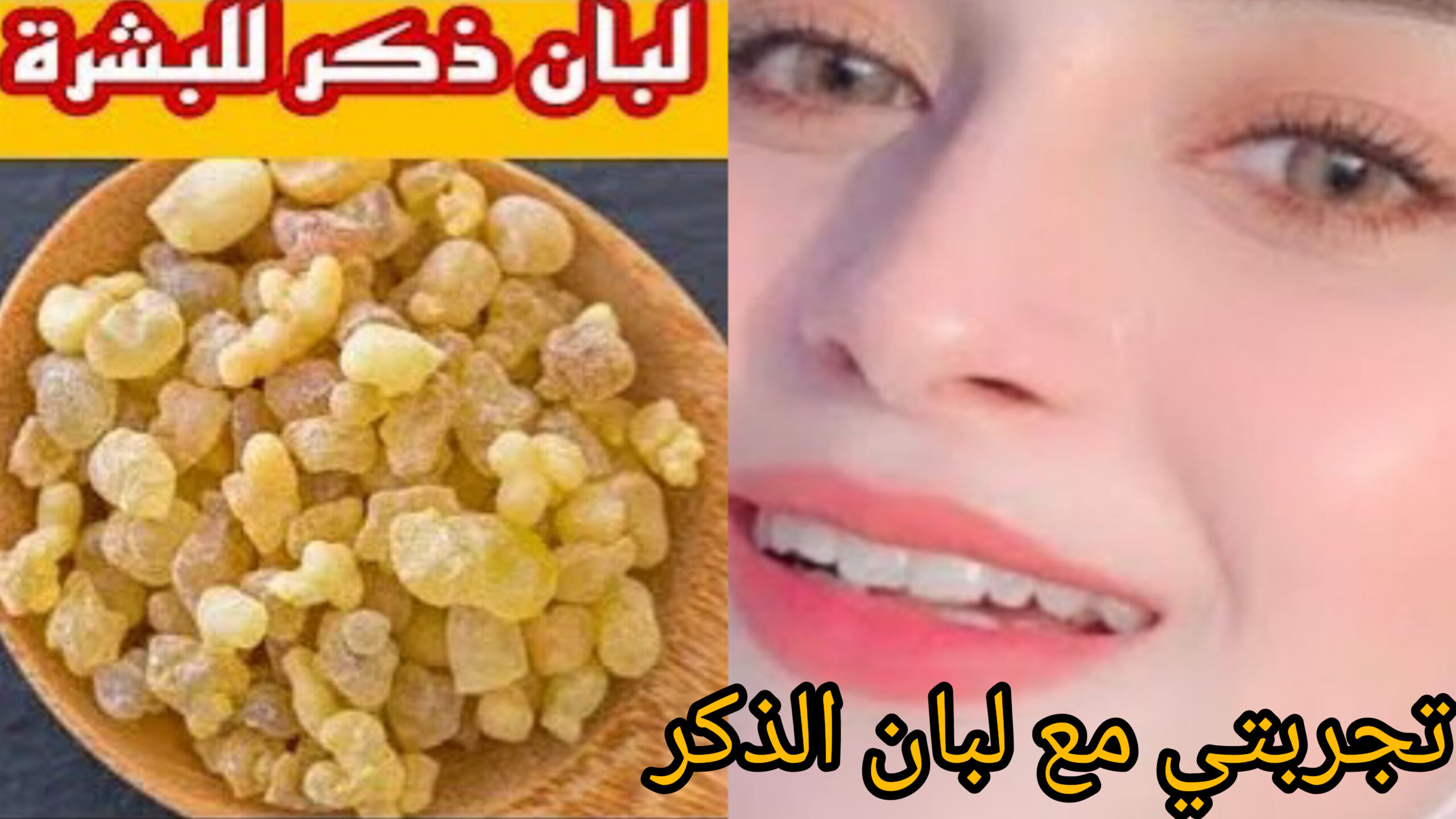 تجربتي مع لبان الذكر للبشرة وكيفية استخدامه