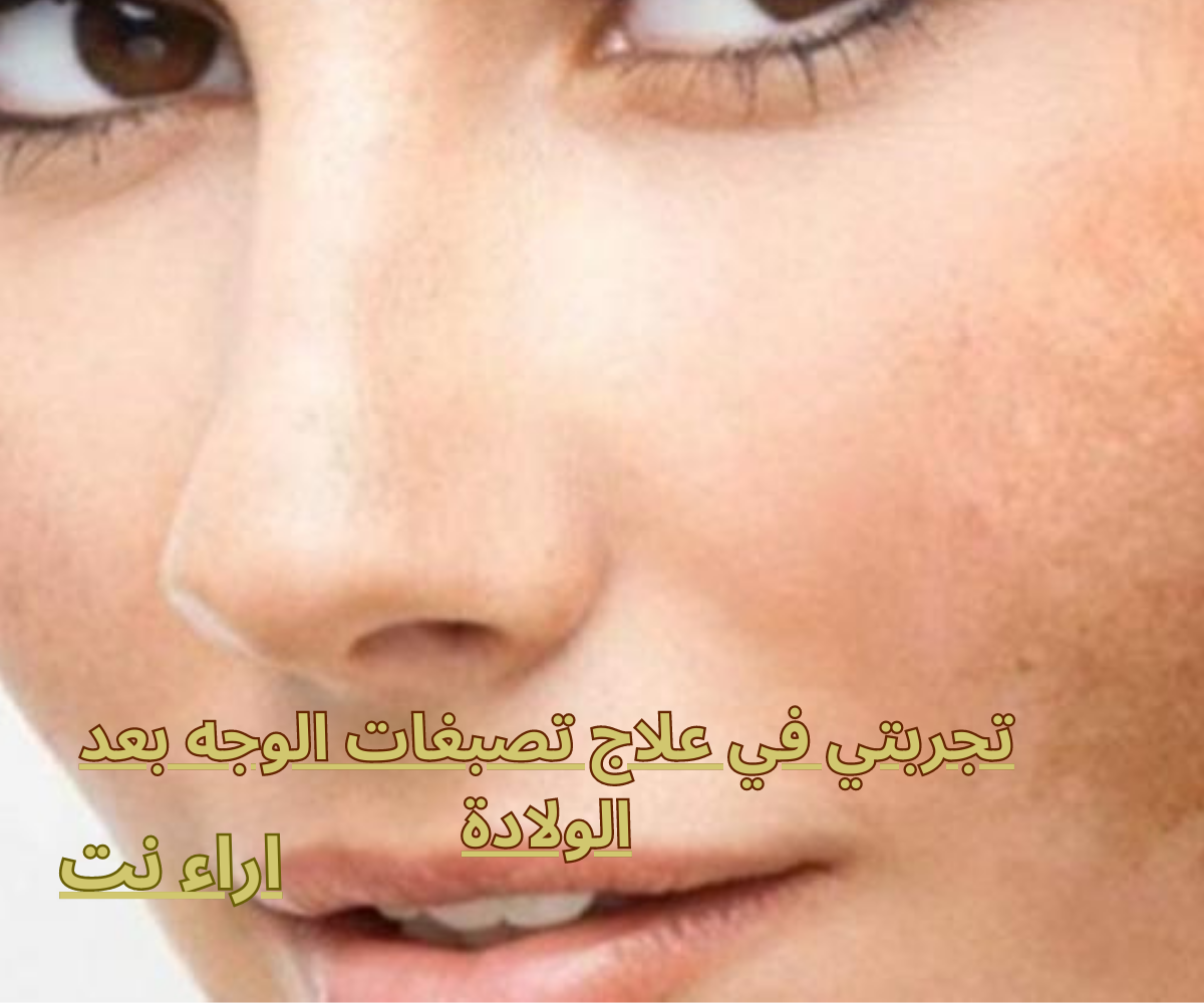 تجربتي في علاج تصبغات الوجه بعد الولادة