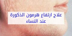 تجربتي في علاج هرمون الذكورة عند النساء للحمل