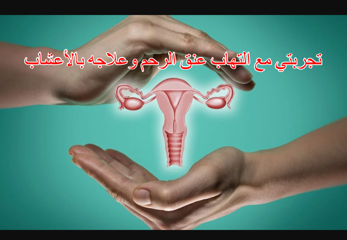 تجربتي مع التهاب عنق الرحم وعلاجه بالأعشاب