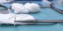 تجربتي مع الخياطة التجميلية بعد الولادة وهل لها اثار