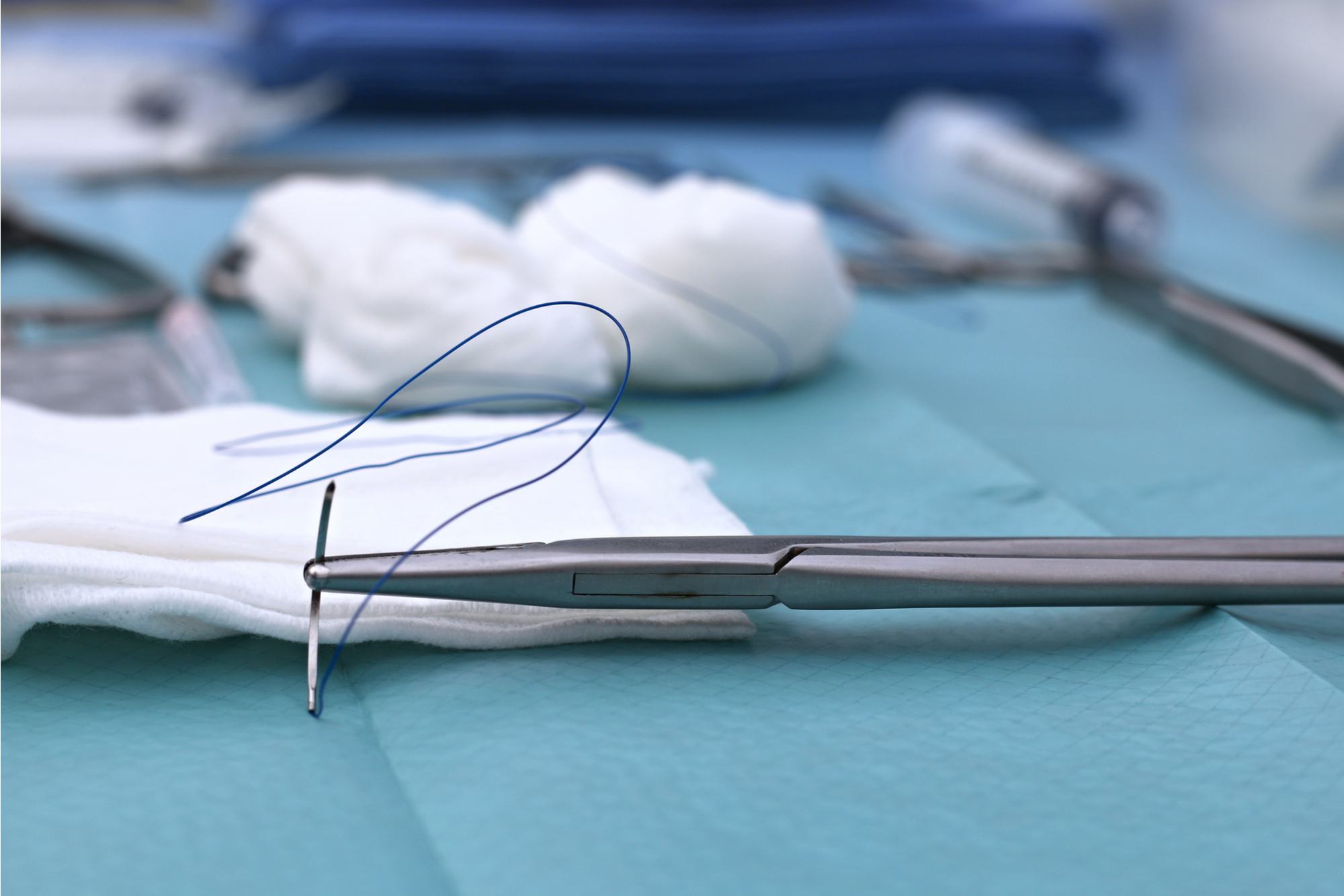 تجربتي مع الخياطة التجميلية بعد الولادة وهل لها اثار
