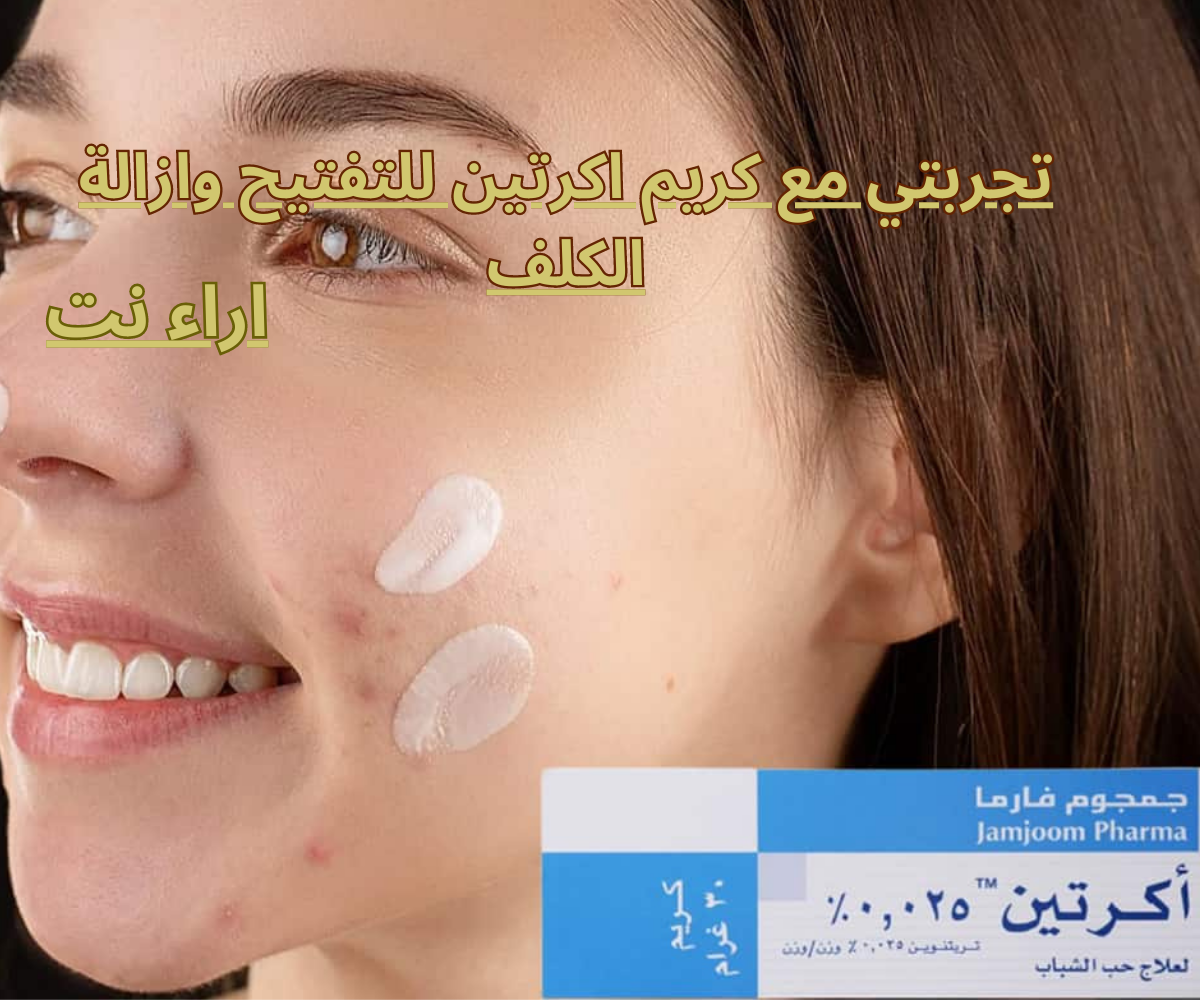 تجربتي مع كريم اكرتين للتفتيح وازالة الكلف