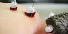 افضل وقت للحجامة لتنشيط المبايض