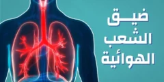 تجربتي مع التهاب الشعب الهوائية المزمن