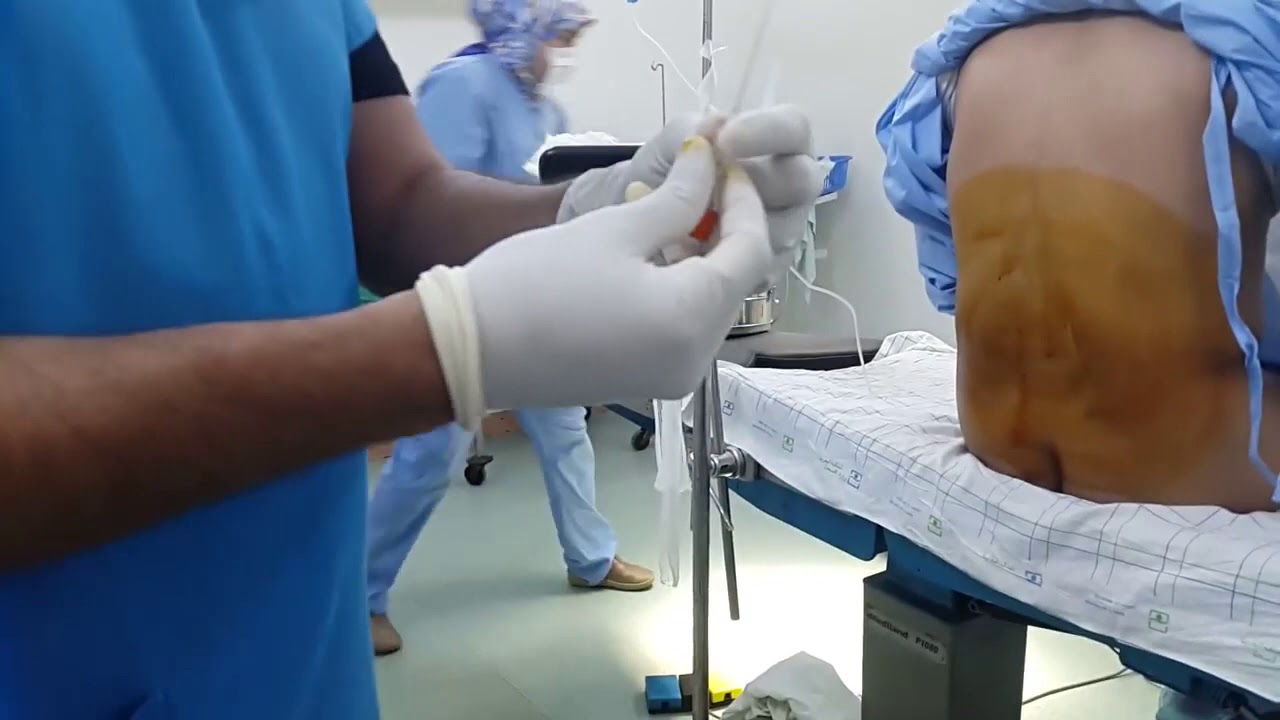 تجربتي مع الخزعة الظهر