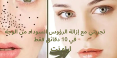 تجربتي مع إزالة الرؤوس السوداء من الوجه في 10 دقائق فقط