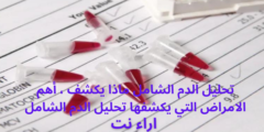 تحليل الدم الشامل ماذا يكشف ، أهم الامراض التي يكشفها تحليل الدم الشامل