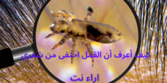 كيف أعرف أن القمل اختفى من شعري