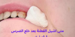 متى اشيل القطنة بعد خلع الضرس