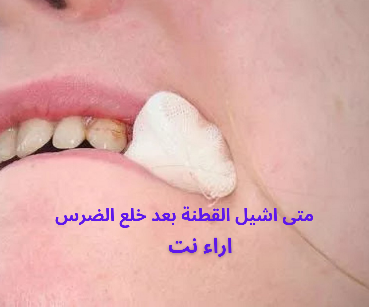 متى اشيل القطنة بعد خلع الضرس