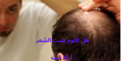 هل الثوم ينبت الشعر