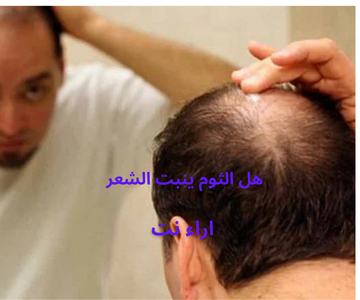 هل الثوم ينبت الشعر