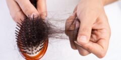 هل نقص الحديد يسبب تساقط الشعر