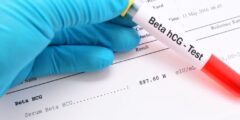 كيف تقرأ تحليل الحمل الرقمي hCG