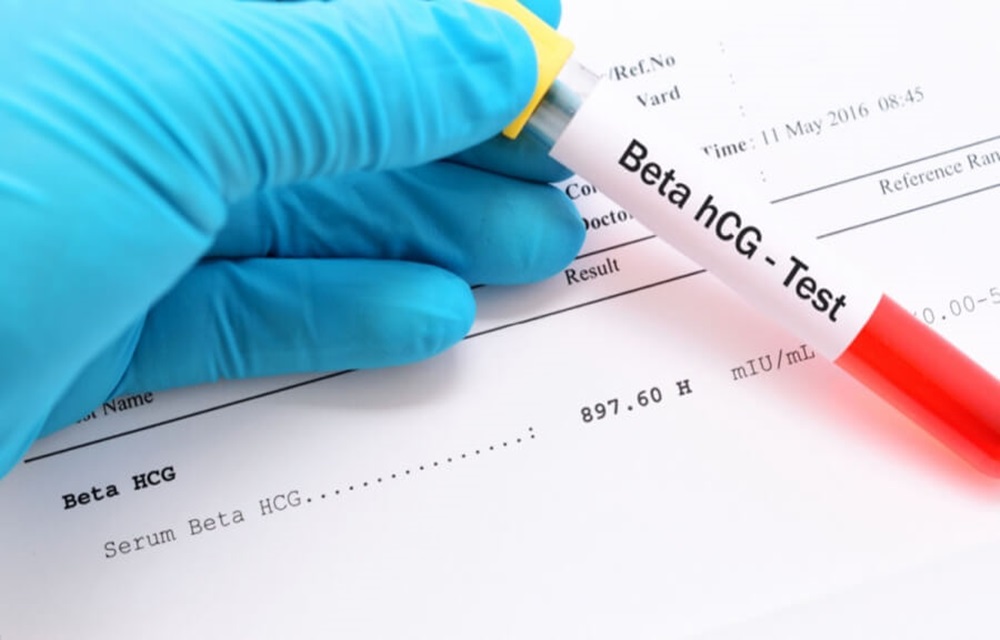 كيف تقرأ تحليل الحمل الرقمي hCG